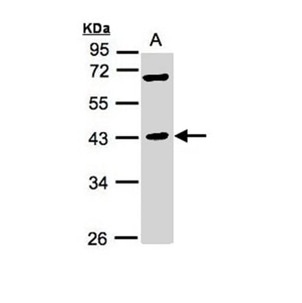 MURF1 antibody from Signalway Antibody (22863) - Antibodies.com