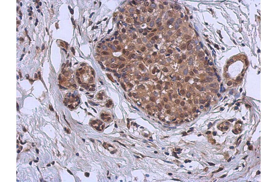 Immunohistochemistry - MURF1 antibody from Signalway Antibody (22863) - Antibodies.com