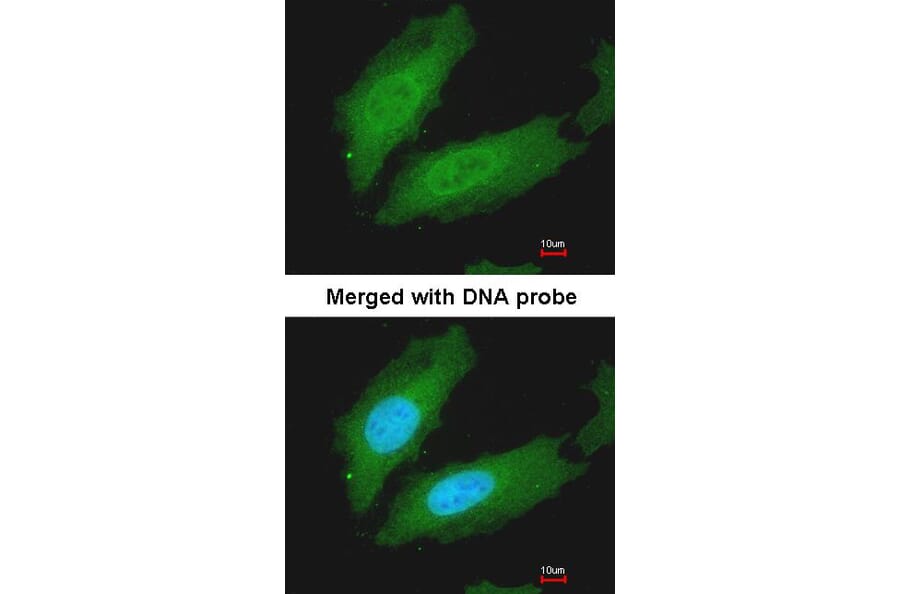 Immunofluorescence - MURF1 antibody from Signalway Antibody (22863) - Antibodies.com