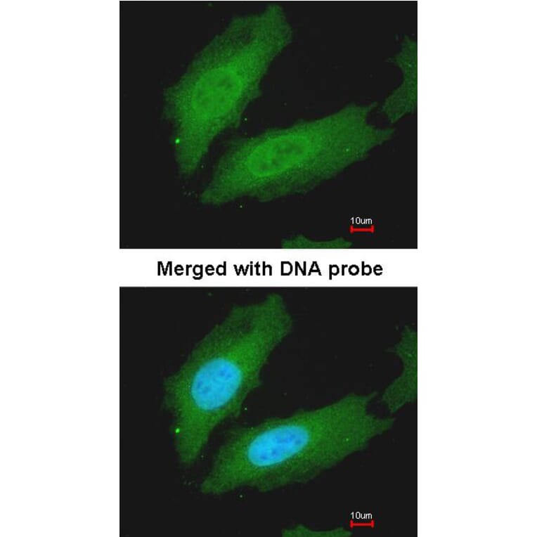 Immunofluorescence - MURF1 antibody from Signalway Antibody (22863) - Antibodies.com