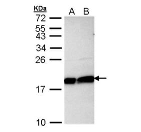 Ube2L3 antibody from Signalway Antibody (22875) - Antibodies.com