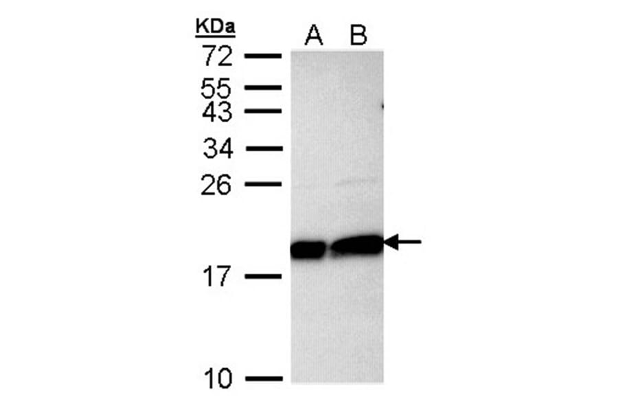 Ube2L3 antibody from Signalway Antibody (22875) - Antibodies.com