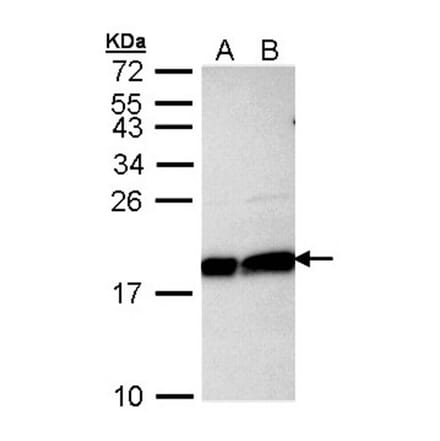 Ube2L3 antibody from Signalway Antibody (22875) - Antibodies.com