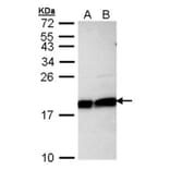 Ube2L3 antibody from Signalway Antibody (22875) - Antibodies.com