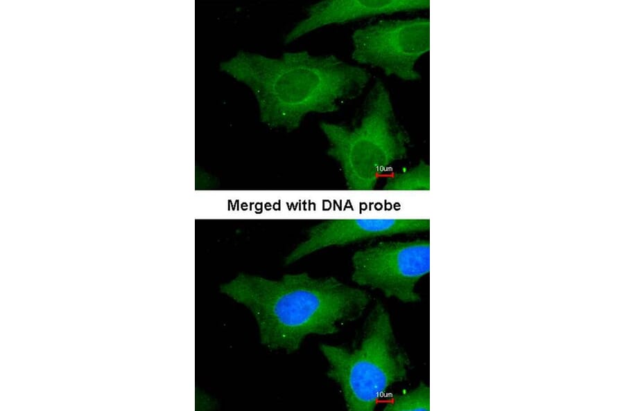 Immunofluorescence - Ube2L3 antibody from Signalway Antibody (22875) - Antibodies.com