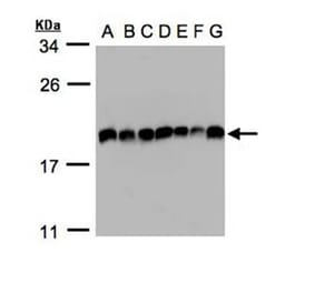 EIF5A2 antibody from Signalway Antibody (22904) - Antibodies.com