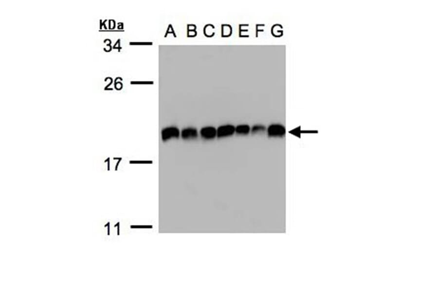 EIF5A2 antibody from Signalway Antibody (22904) - Antibodies.com