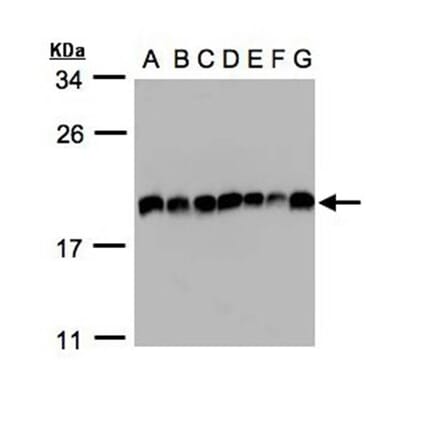 EIF5A2 antibody from Signalway Antibody (22904) - Antibodies.com