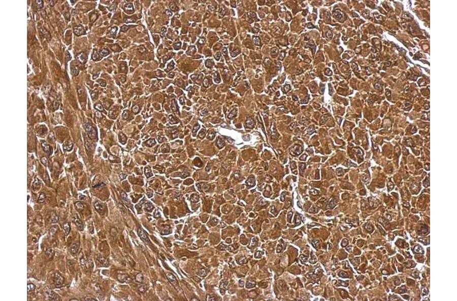 Immunohistochemistry - EIF5A2 antibody from Signalway Antibody (22904) - Antibodies.com