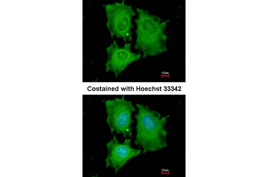 Immunofluorescence - EIF5A2 antibody from Signalway Antibody (22904) - Antibodies.com