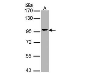 Villin antibody from Signalway Antibody (22921) - Antibodies.com