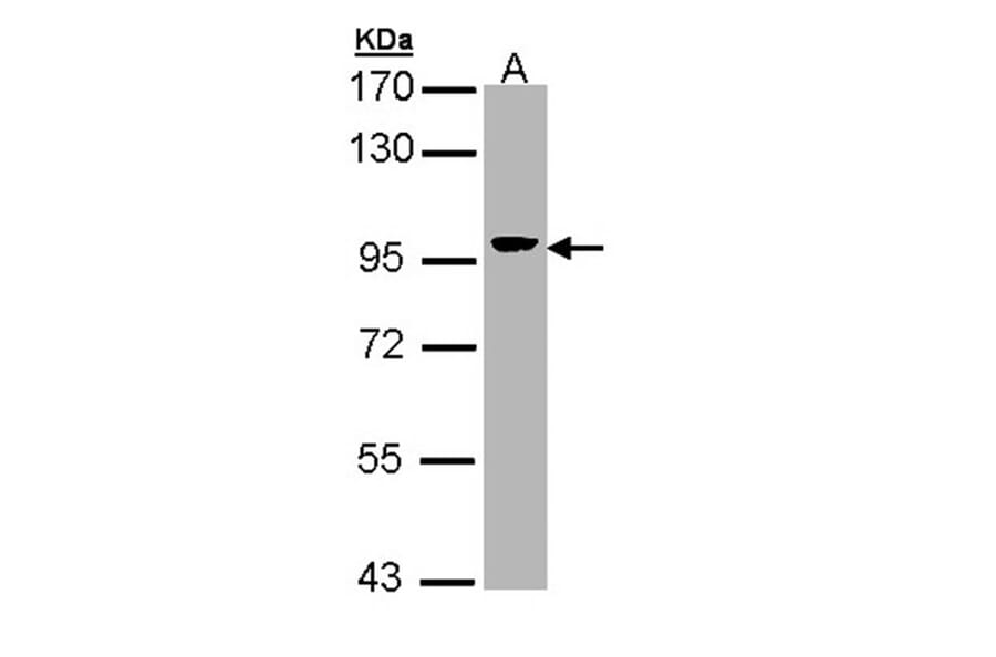 Villin antibody from Signalway Antibody (22921) - Antibodies.com