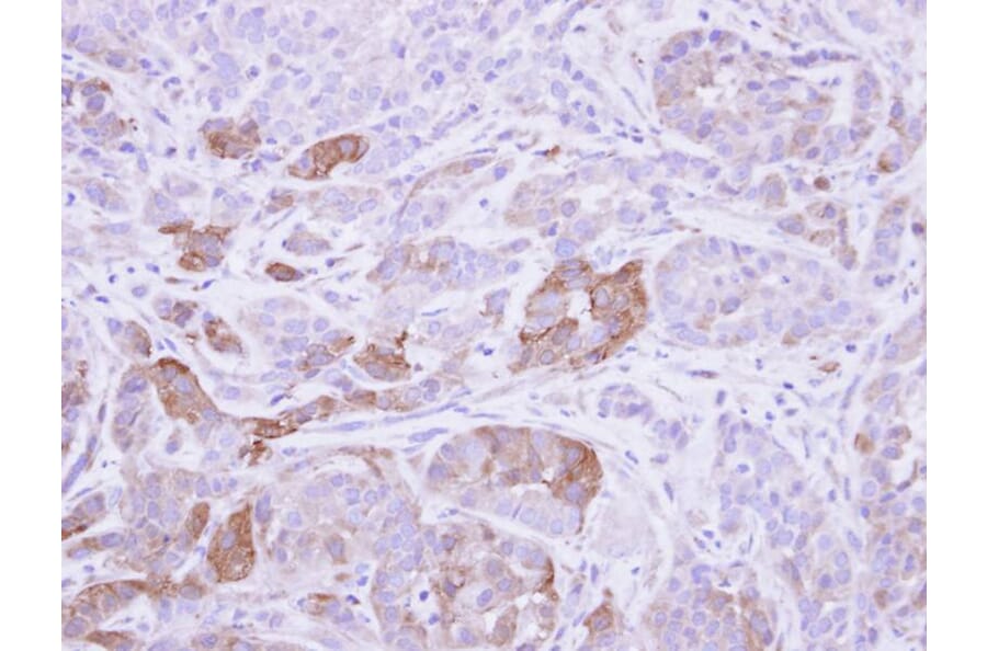 Immunohistochemistry - Villin antibody from Signalway Antibody (22921) - Antibodies.com