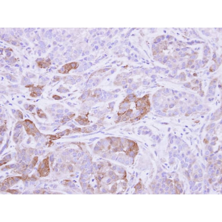 Immunohistochemistry - Villin antibody from Signalway Antibody (22921) - Antibodies.com