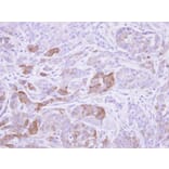 Immunohistochemistry - Villin antibody from Signalway Antibody (22921) - Antibodies.com