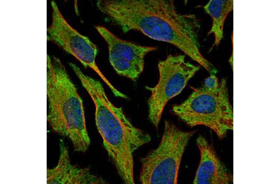 Villin antibody from Signalway Antibody (22921) - Antibodies.com