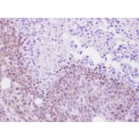 Immunohistochemistry - ML-IAP antibody from Signalway Antibody (22924) - Antibodies.com