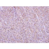 Immunohistochemistry - BCL2L1 antibody from Signalway Antibody (22968) - Antibodies.com