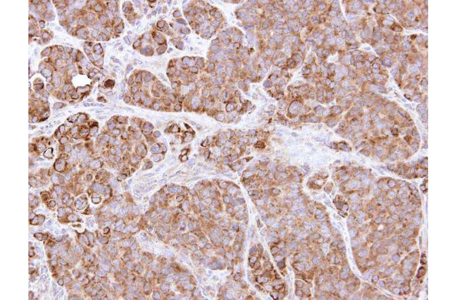 Immunohistochemistry - BCL2L1 antibody from Signalway Antibody (22969) - Antibodies.com