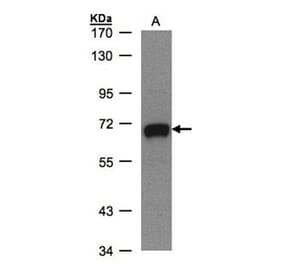 GALNT2 antibody from Signalway Antibody (22999) - Antibodies.com