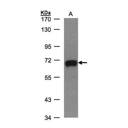 GALNT2 antibody from Signalway Antibody (22999) - Antibodies.com