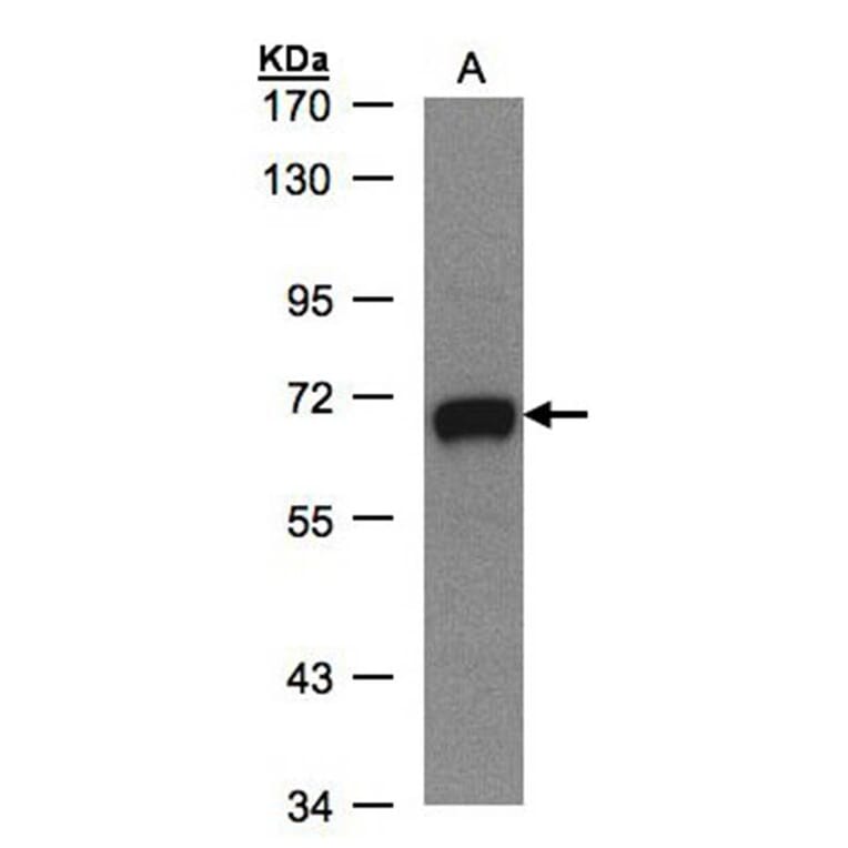 GALNT2 antibody from Signalway Antibody (22999) - Antibodies.com