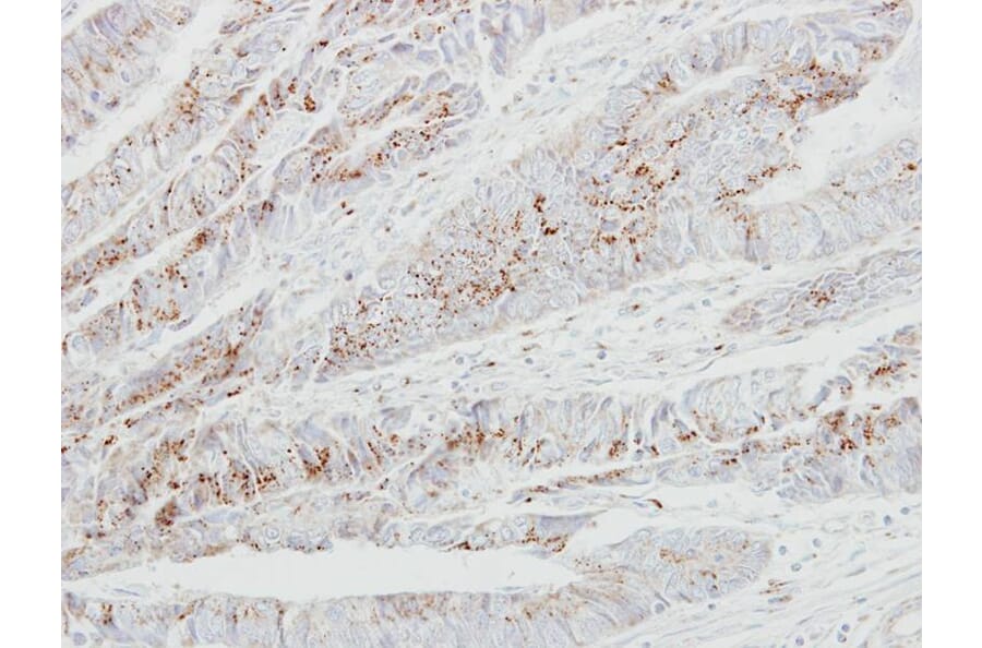 Immunohistochemistry - GALNT2 antibody from Signalway Antibody (22999) - Antibodies.com