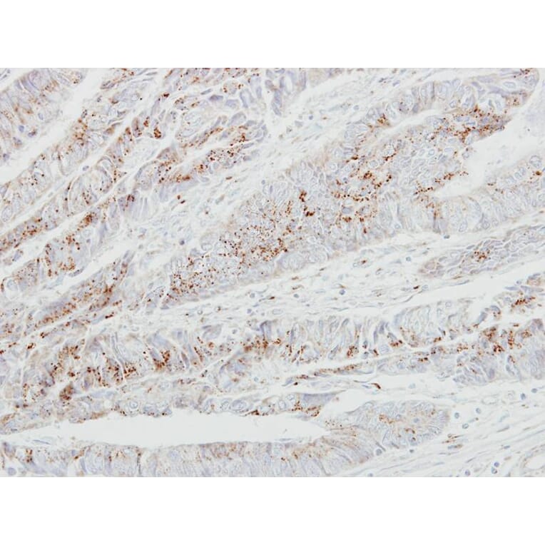 Immunohistochemistry - GALNT2 antibody from Signalway Antibody (22999) - Antibodies.com
