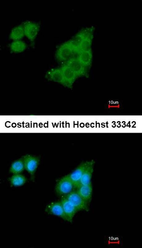 Immunofluorescence analysis of methanol-fixed HepG2, using GALNT2 antibody at 1: 200 dilution.