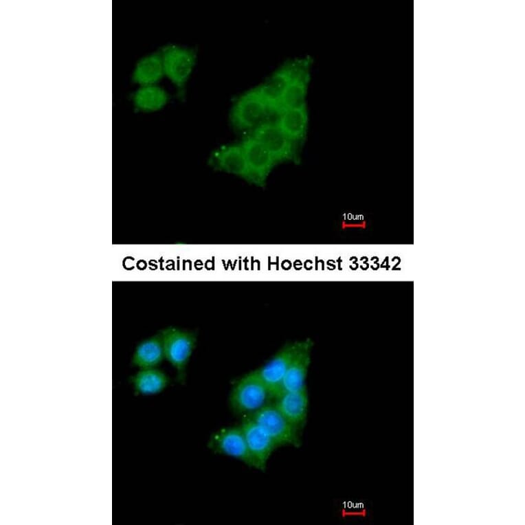 Immunofluorescence - GALNT2 antibody from Signalway Antibody (22999) - Antibodies.com