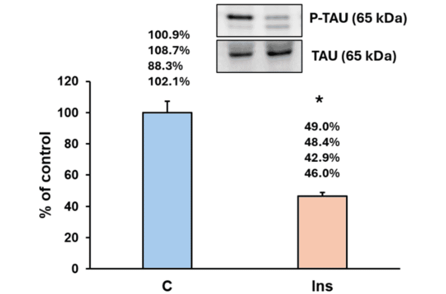 ELISA - Anti-p-Tau Antibody (A34931) - Antibodies.com Citation