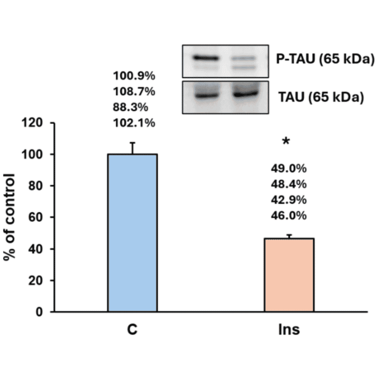 ELISA - Anti-p-Tau Antibody (A34931) - Antibodies.com Citation