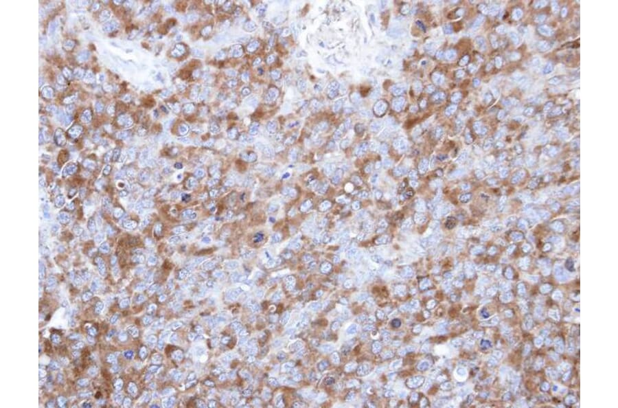 Immunohistochemistry - p-Tau antibody from Signalway Antibody (23041) - Antibodies.com