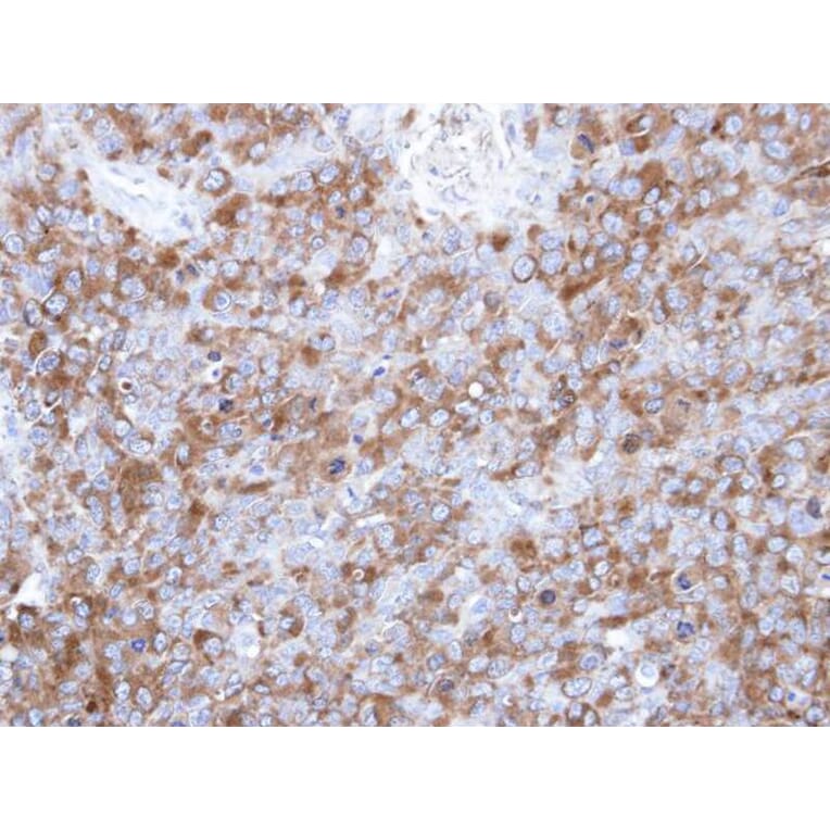 Immunohistochemistry - p-Tau antibody from Signalway Antibody (23041) - Antibodies.com