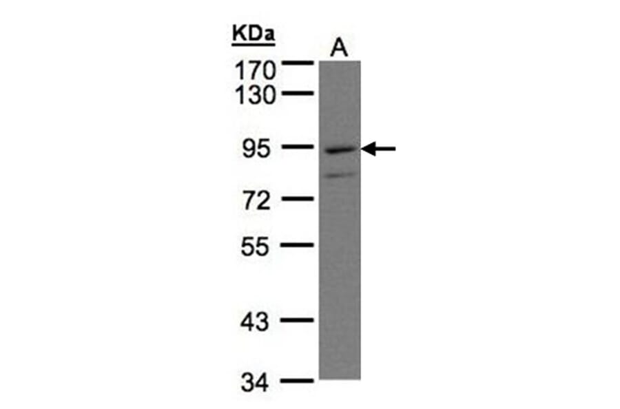PTGFRN antibody from Signalway Antibody (23064) - Antibodies.com