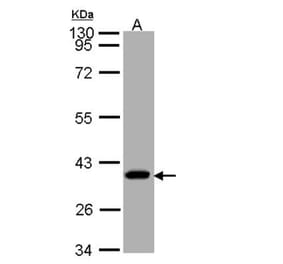 SUCLG1 antibody from Signalway Antibody (23091) - Antibodies.com