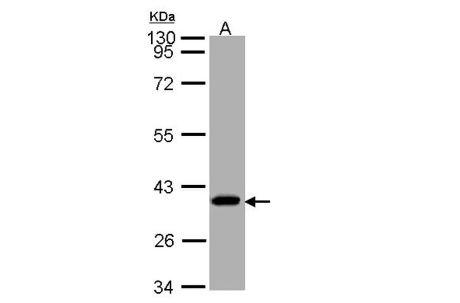 SUCLG1 antibody from Signalway Antibody (23091) - Antibodies.com
