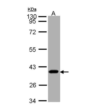 SUCLG1 antibody from Signalway Antibody (23091) - Antibodies.com