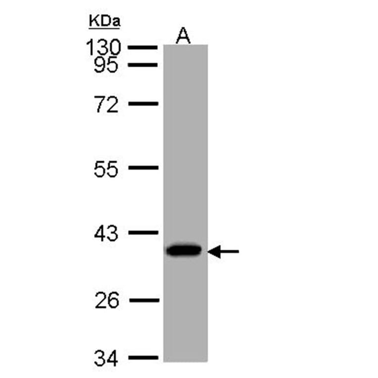 SUCLG1 antibody from Signalway Antibody (23091) - Antibodies.com