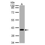 SUCLG1 antibody from Signalway Antibody (23091) - Antibodies.com