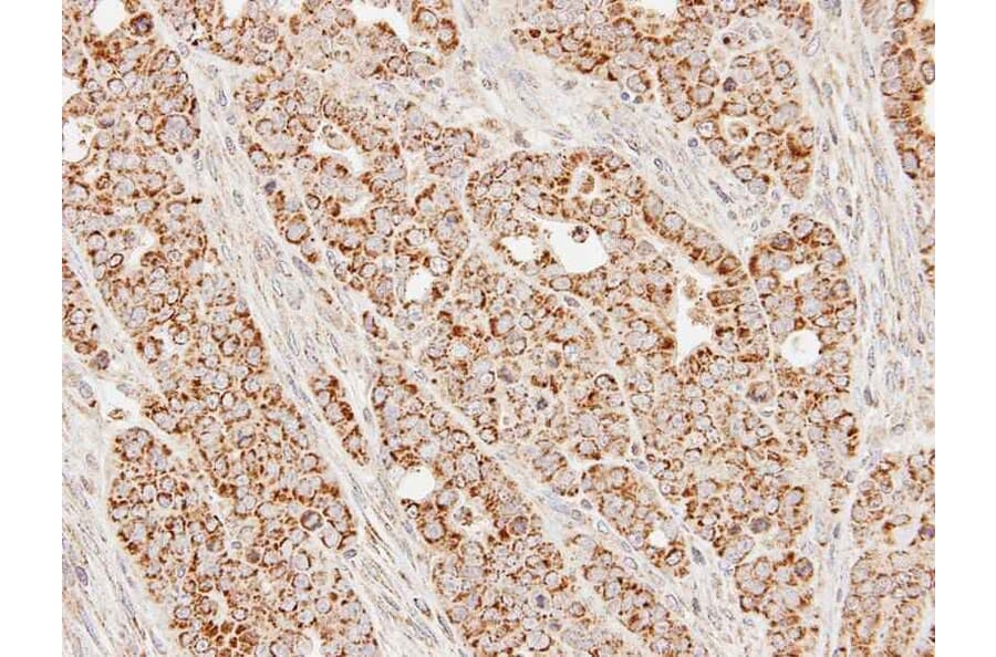 Immunohistochemistry - SUCLG1 antibody from Signalway Antibody (23091) - Antibodies.com