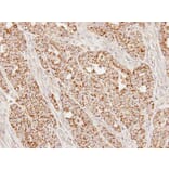 Immunohistochemistry - SUCLG1 antibody from Signalway Antibody (23091) - Antibodies.com