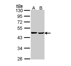 SUCLA2 antibody from Signalway Antibody (23092) - Antibodies.com