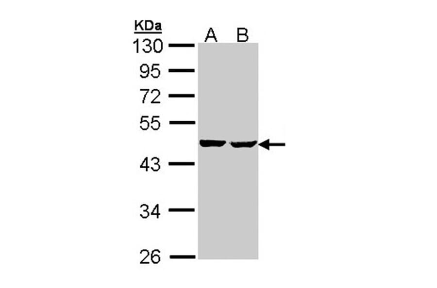 SUCLA2 antibody from Signalway Antibody (23092) - Antibodies.com