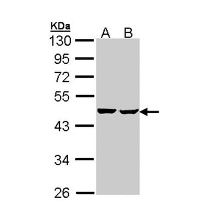 SUCLA2 antibody from Signalway Antibody (23092) - Antibodies.com