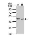 SUCLA2 antibody from Signalway Antibody (23092) - Antibodies.com