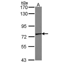 GALNT7 antibody from Signalway Antibody (23130) - Antibodies.com
