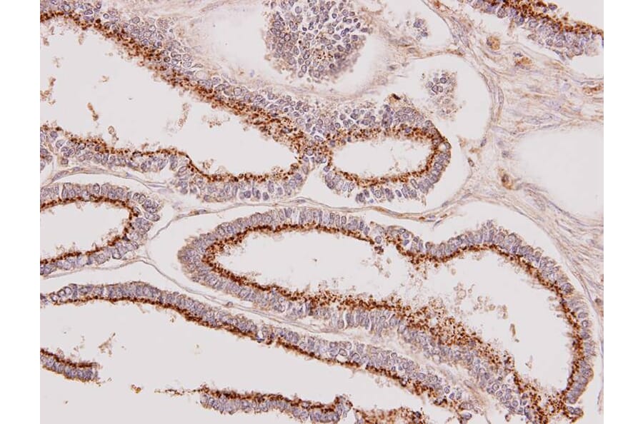 Immunohistochemistry - GALNT7 antibody from Signalway Antibody (23130) - Antibodies.com