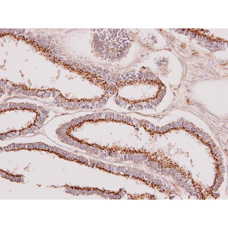 Immunohistochemistry - GALNT7 antibody from Signalway Antibody (23130) - Antibodies.com