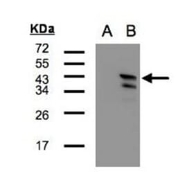 Western blot - CAMK1D antibody from Signalway Antibody (23142) - Antibodies.com